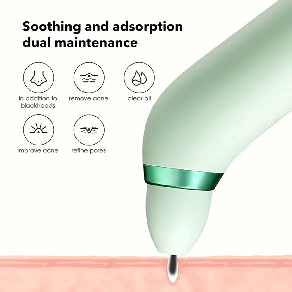 Blackhead Remover with Camera and Suction Probes J546837