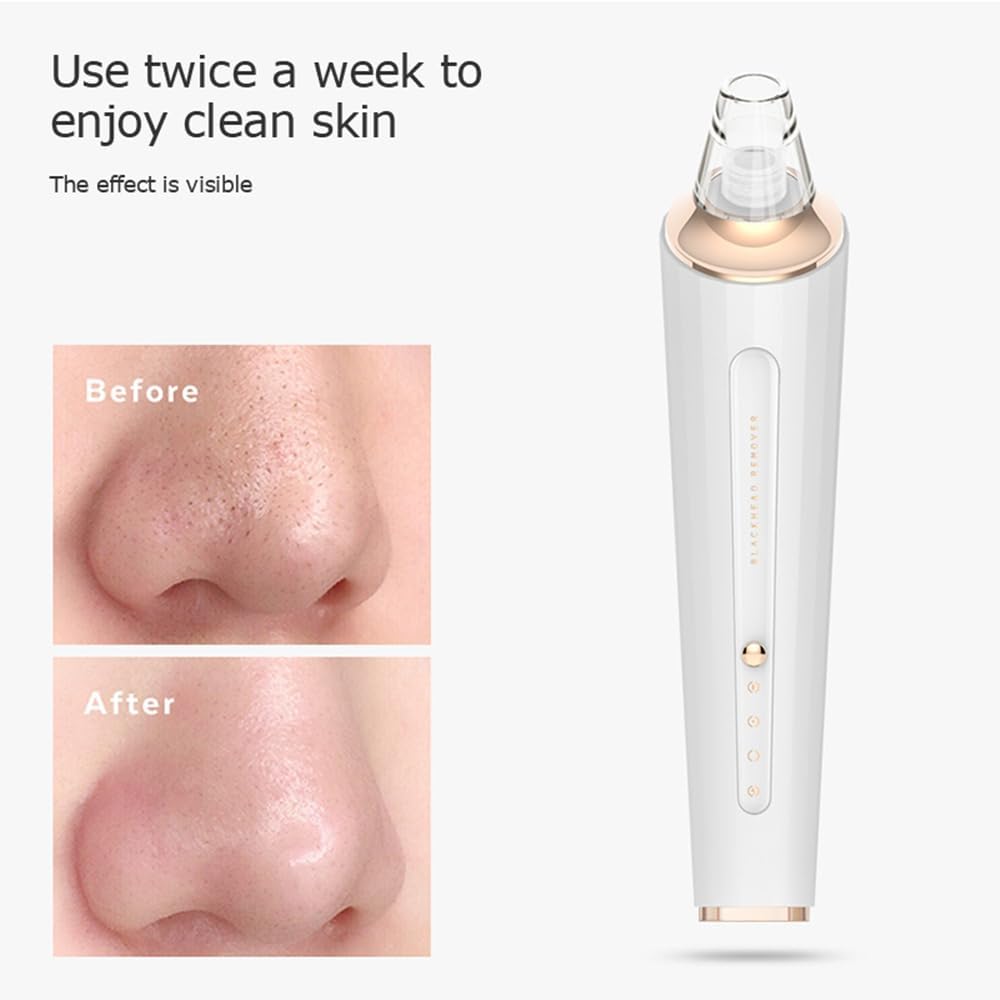 Black Head Remover Tool with 4 Probes & 3 Modes Y4720