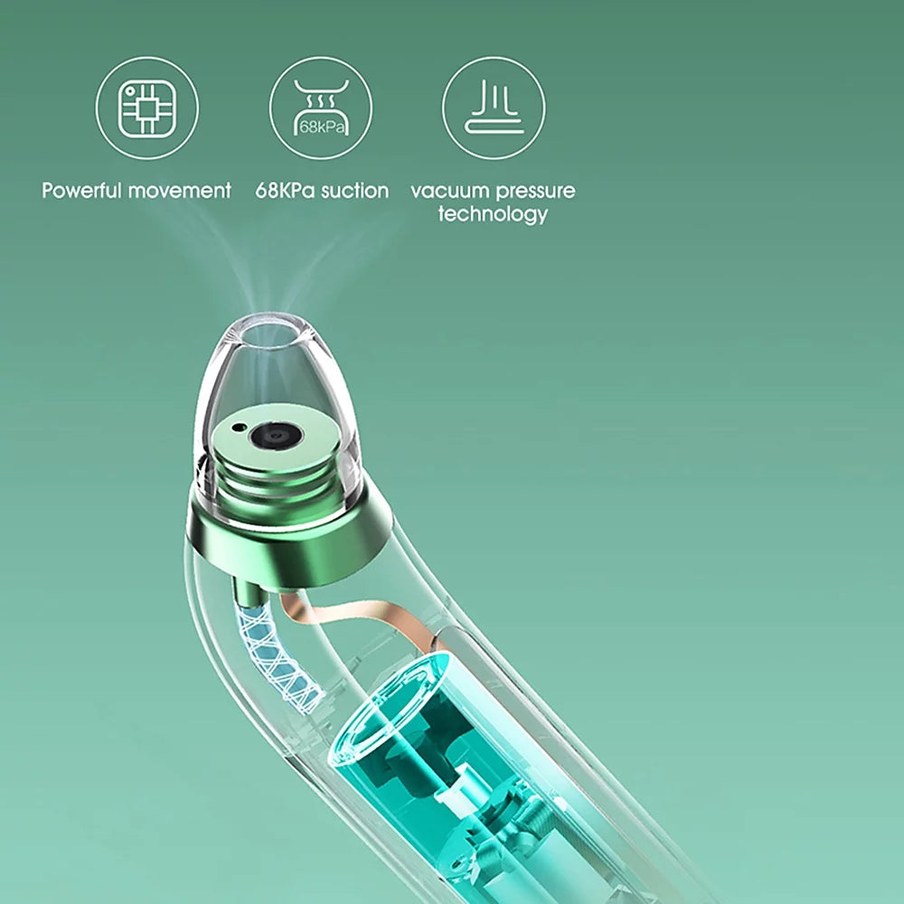 Blackhead Remover with Camera and Suction Probes J546837
